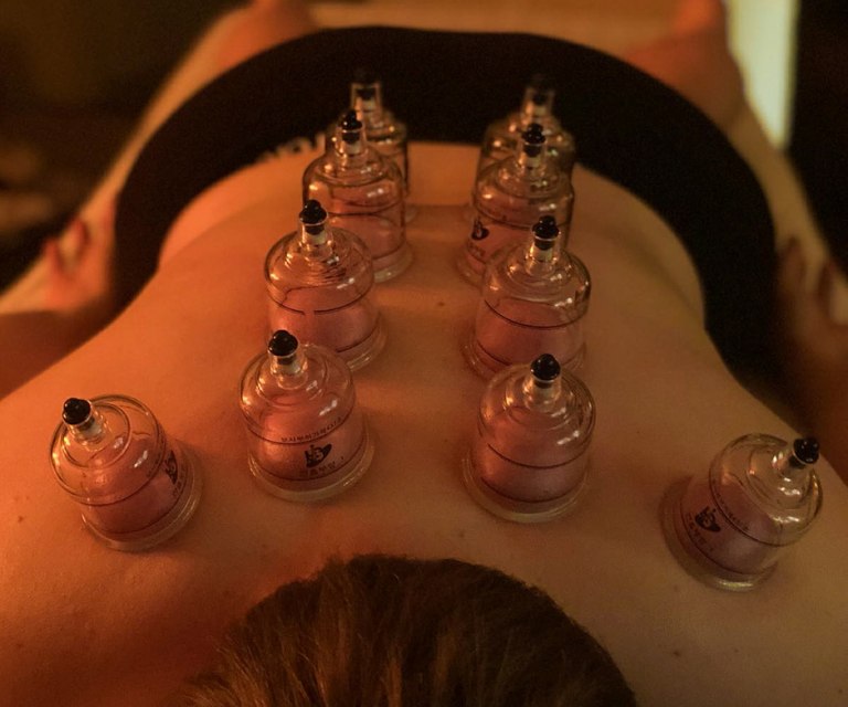 Cupping Massage